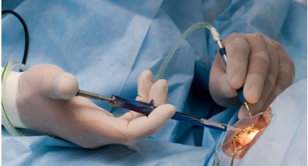 Cataract and Refractive Surgery Cataract and Refractive Surgery